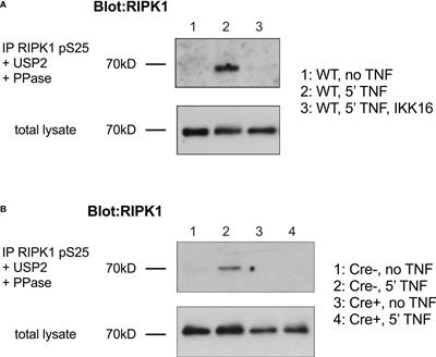 Phosphorylation of RIPK1 serine 25 mediates IKK dependent control of extrinsic cell death in T cells